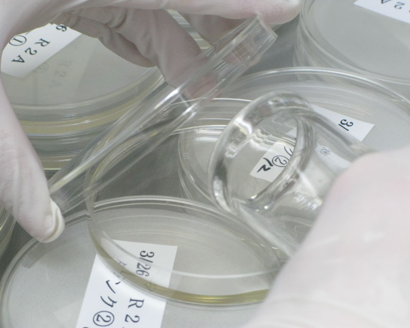 細菌検査のためにシャーレに検体を移しているところ